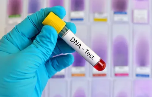 Serikali yapandisha gharama za kupima DNA Tanzania
